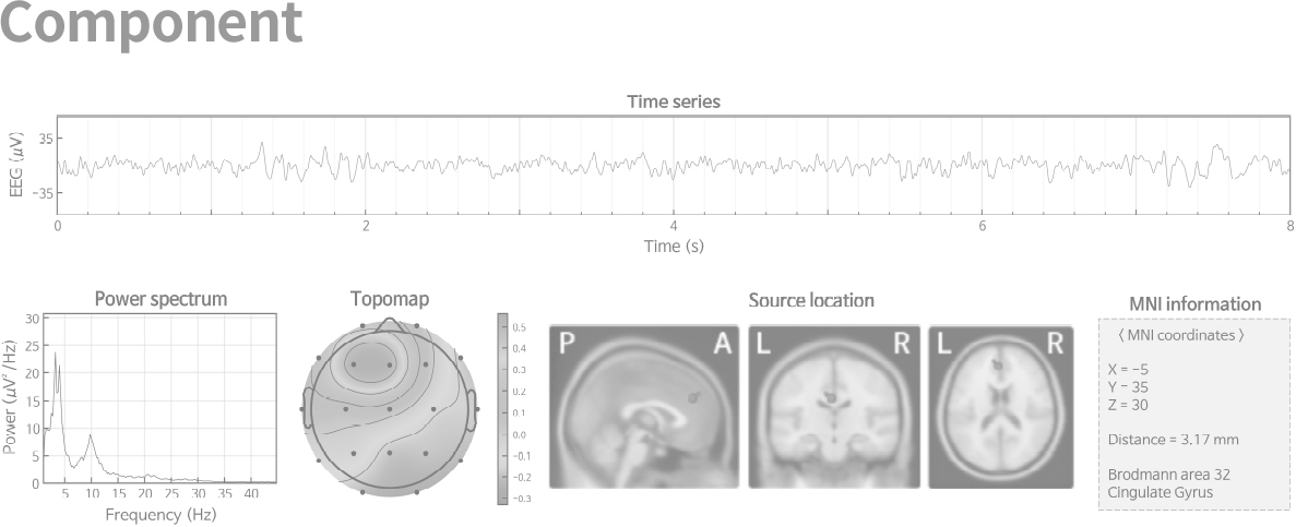 Brain Map topografic — harti 3D per banda de frecventa