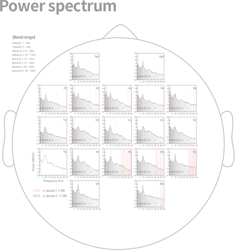 Analiza spectrala — Z-score per canal EEG